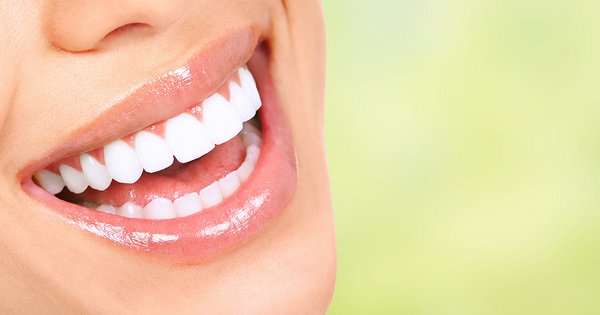 Zahnlücken schließen: Methoden und Vorteile
